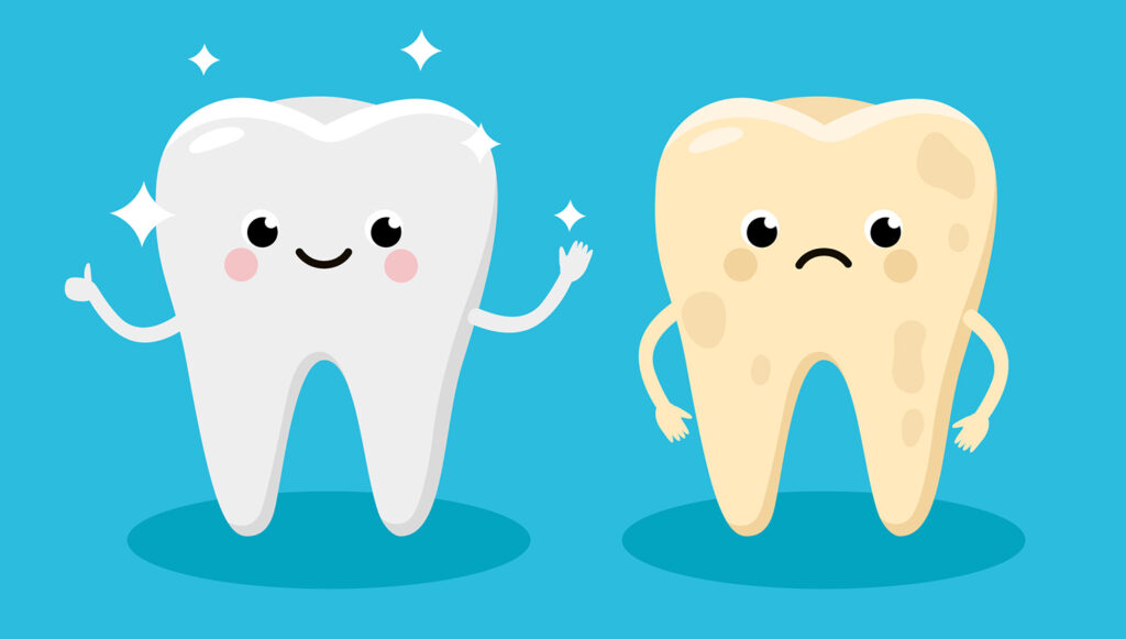 How Bad Are Your Teeth? | Suggestion Based On 20 Factors